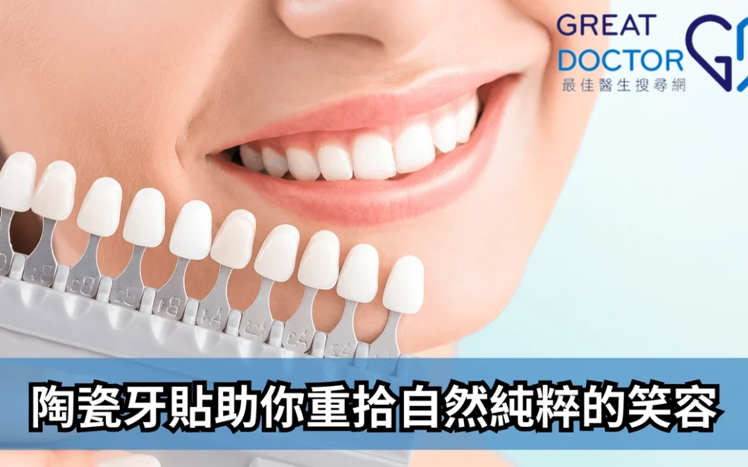 《Greatdoctor》報導：陶瓷牙貼助你重拾自然純粹的笑容